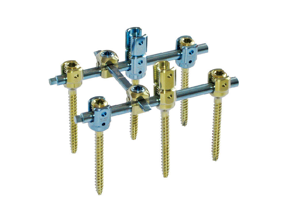 Internal Spinal Fixation System (Ⅶ) Internal Spinal Fixation System (Ⅶ)
