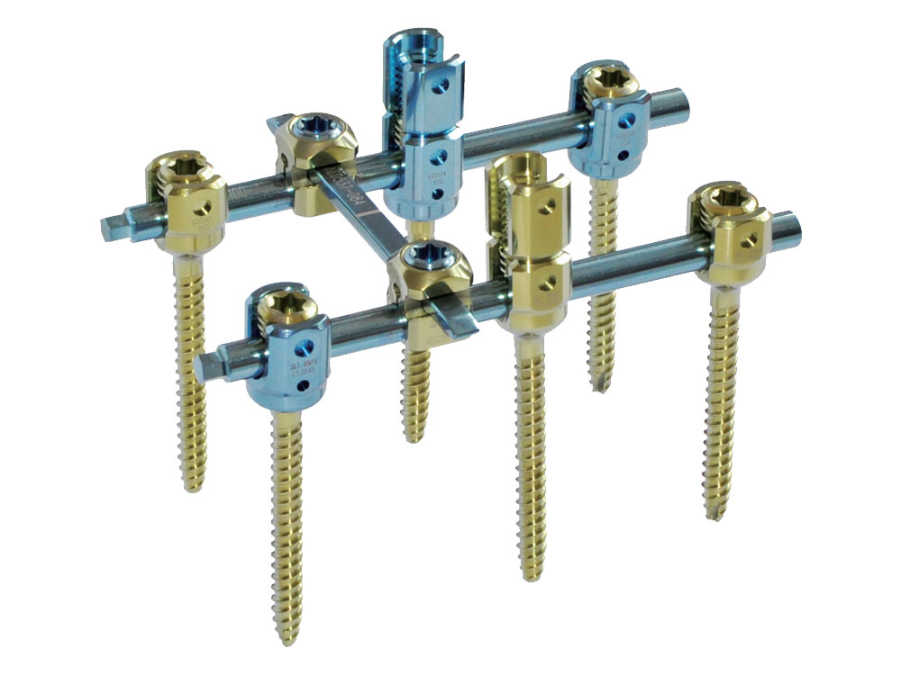 Internal Spinal Fixation System (VII) Internal Spinal Fixation System (VII)