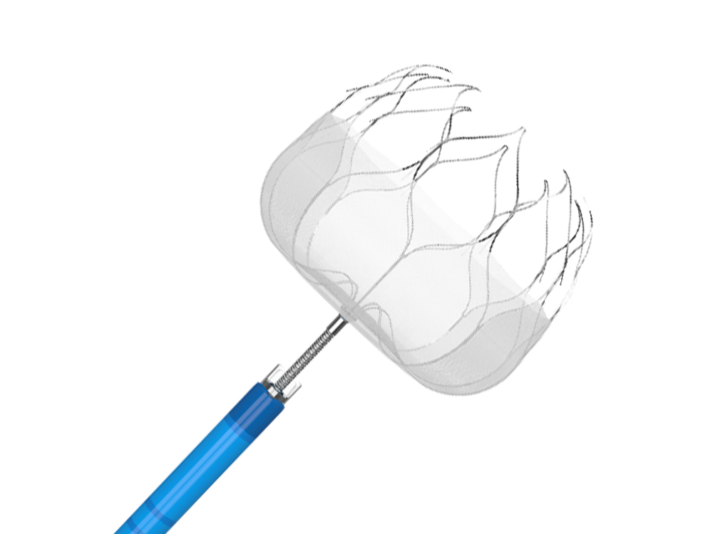 Application and Classification of Left Atrial Appendage Occluder Application and Classification of Left Atrial Appendage Occluder