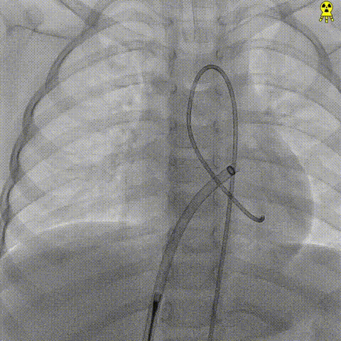 1741576175669.gif 1741576175669.gif